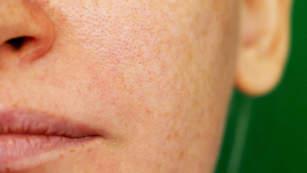 תקריב של פיגמנטציה בעור