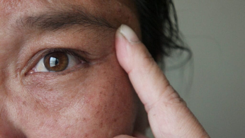 אישה עם נמשים