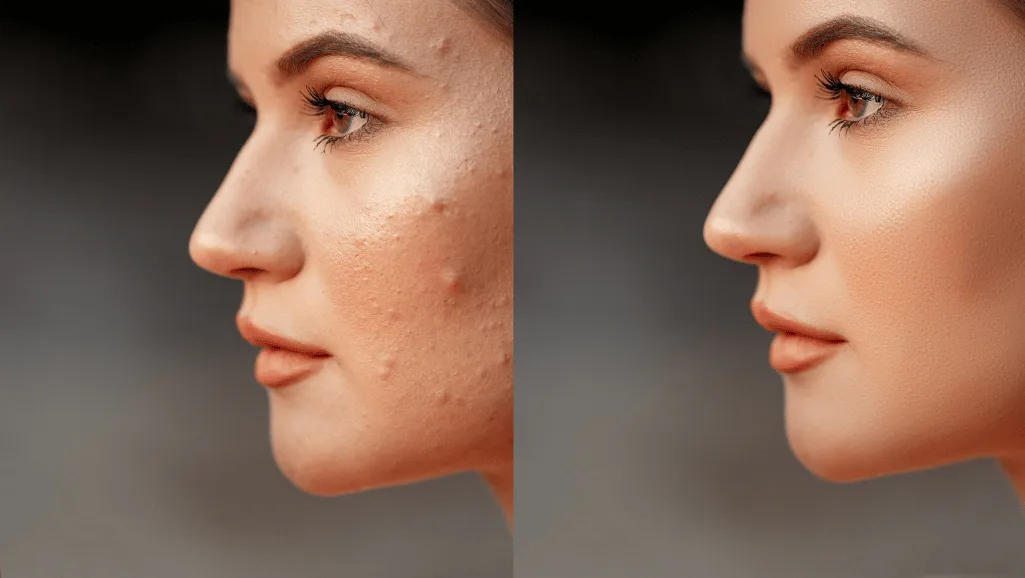 אישה עם חצ'קון לפני ואחרי