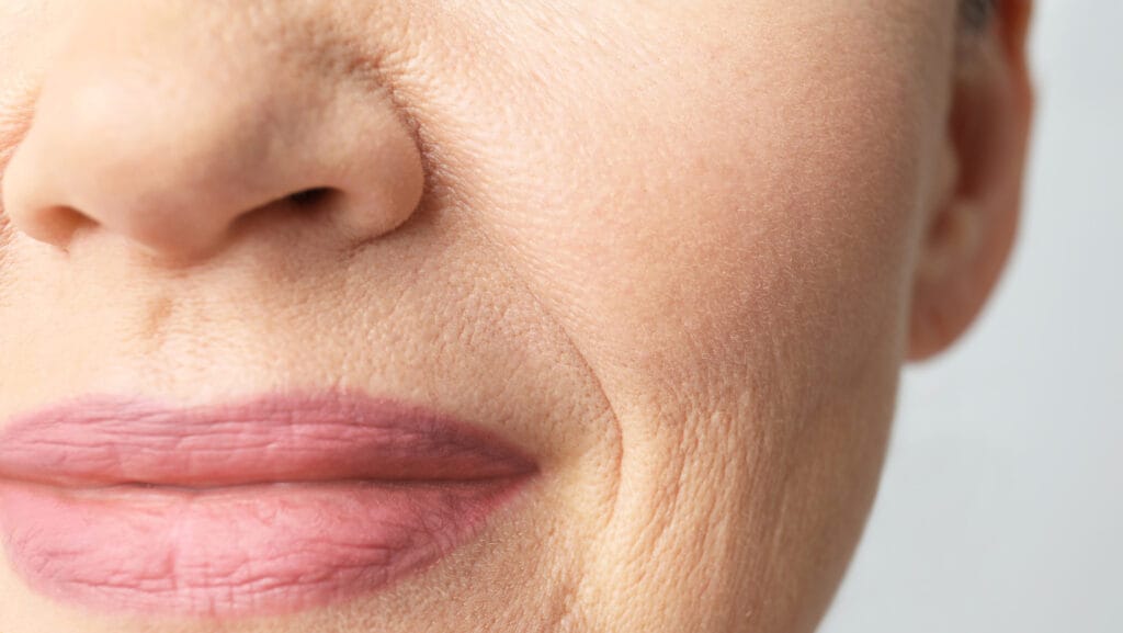 תמונה של אישה עם קמטים בצידי הפה תקריב