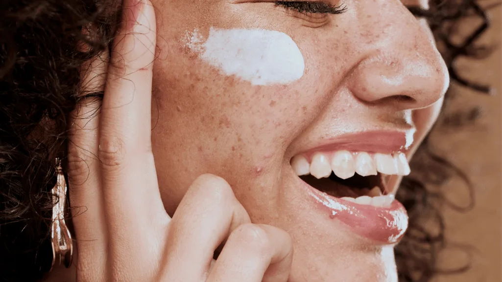 אישה מנומשת שמה קרם לחות על העור