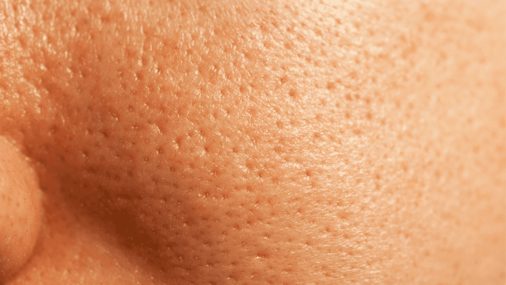 נקבוביות פעורות