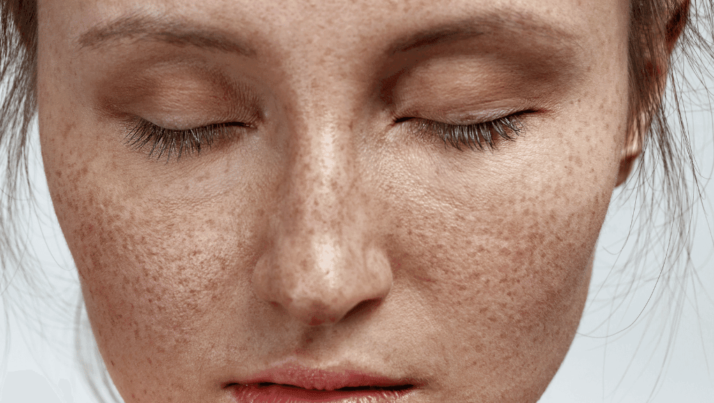 אישה עם נמשים עוצמת עיניים