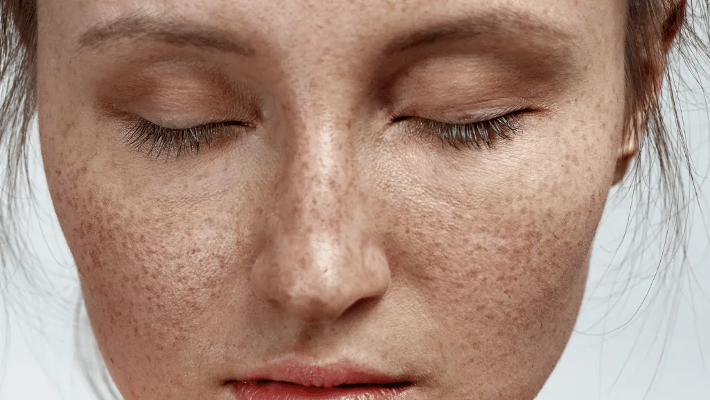 אישה עם נמשים עוצמת עיניים