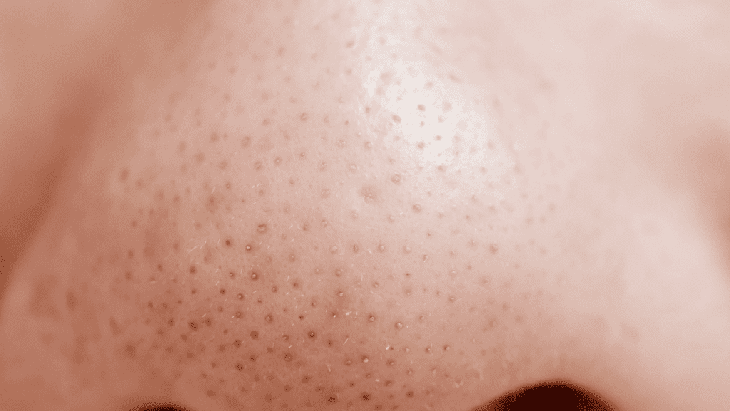 תמונת תקריב של נקבוביות